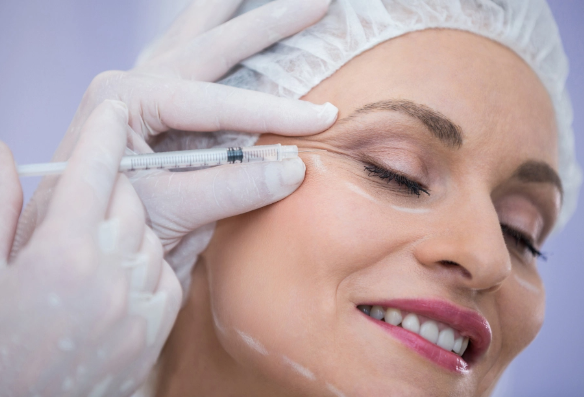 Botox-Mythen, die Sie kennen sollten, bevor Sie sich für eine Behandlung entscheiden